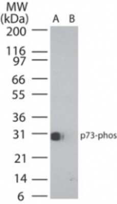 Western Blot: p73 [p Tyr99] Antibody [NB100-56069] - analysis of phosphorylated p73 in (A) recombinant fusion protein containing phosphorylated tyrosine at position 99 and (B) fusion partner without this amino acid, using this antibody. 25 ug/ml.